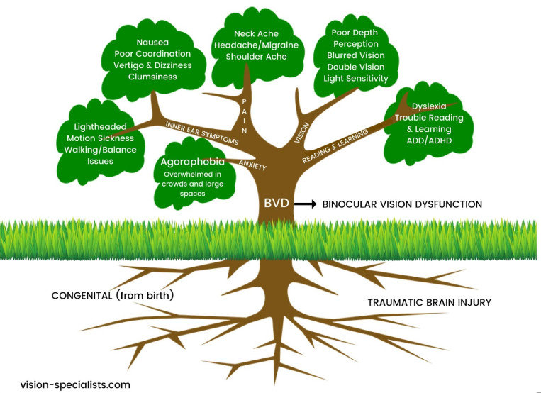 binocular vision dysfunction